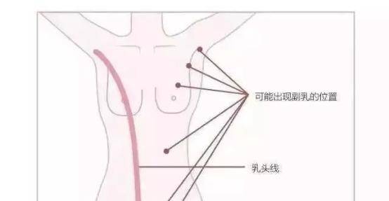 副乳和赘肉的区别图片:副乳和赘肉的区别,你真的分得清吗?附图解析 副乳和赘肉的区别图片:副乳和赘肉的区别,你真的分得清吗?附图解析