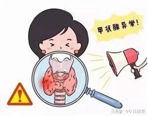 甲减能彻底治愈吗：甲减能彻底治愈吗？医生解答来了！