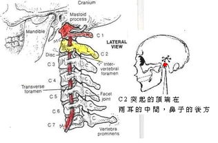 神经根型颈椎病:认识神经根型颈椎病,症状、诊断与治疗策略