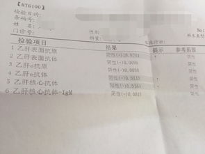 乙肝五项化验单怎么看:乙肝五项化验单怎么看?手把手教你解读这份健康报告