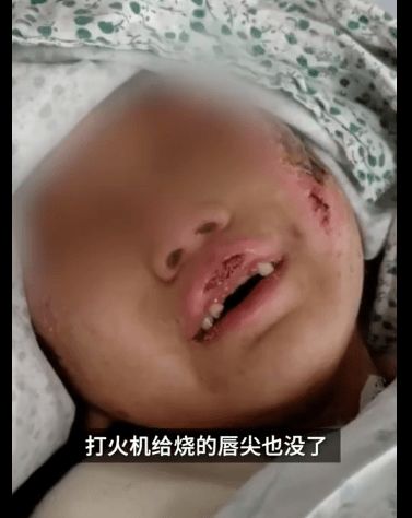 50多岁男人梦见掉牙:中年危机还是内心焦虑?50多岁男人梦见掉牙的心理解读 50多岁男人梦见掉牙:中年危机还是内心焦虑?50多岁男人梦见掉牙的心理解读