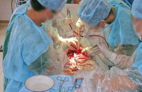 三次剖腹产还能再生吗:三次剖腹产还能再生吗?医生给出的答案令人意外! 三次剖腹产还能再生吗:三次剖腹产还能再生吗?医生给出的答案令人意外!
