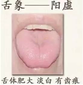 梦见自己舌头掉了半截:梦里舌头掉了半截,一场关于表达与身份的隐喻 梦见自己舌头掉了半截:梦里舌头掉了半截,一场关于表达与身份的隐喻