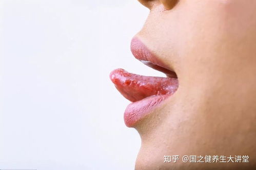梦见自己舌头掉了半截:梦里舌头掉了半截,一场关于表达与身份的隐喻 梦见自己舌头掉了半截:梦里舌头掉了半截,一场关于表达与身份的隐喻