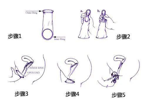 避孕套女用:女用避孕套,女性掌握避孕主动权的私密选择