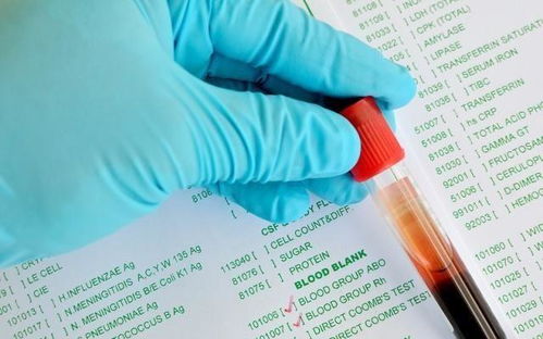 女人什么血型最聪明:血型与智商的民间说法,科学视角下的女性特质解读 女人什么血型最聪明:血型与智商的民间说法,科学视角下的女性特质解读