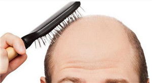 梦见头发稀少:梦里掉头发,我快秃了!解析梦见头发稀少的背后原因 梦见头发稀少:梦里掉头发,我快秃了!解析梦见头发稀少的背后原因