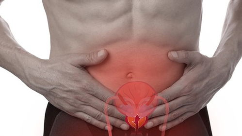 前列腺炎症状表现具体有哪些:前列腺炎症状表现全解析,你了解自己的身体信号吗? 前列腺炎症状表现具体有哪些:前列腺炎症状表现全解析,你了解自己的身体信号吗?