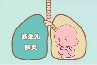 孩子得脑炎最简单的判断方法:孩子得脑炎最简单的判断方法,家长必看! 孩子得脑炎最简单的判断方法:孩子得脑炎最简单的判断方法,家长必看!