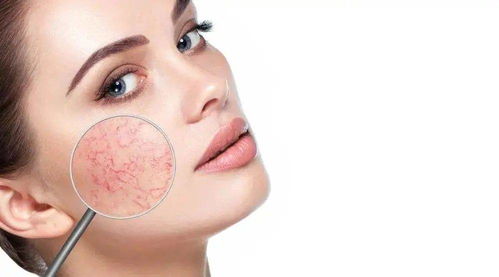 脸上长痘痘去医院挂什么科:脸上长痘痘挂什么科?皮肤科是首选!