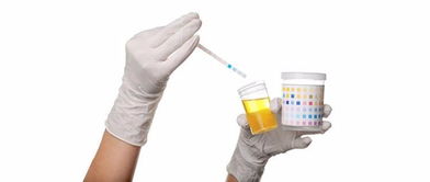 蛋白尿的症状及危害:蛋白尿,你不可忽视的肾脏健康信号 蛋白尿的症状及危害:蛋白尿,你不可忽视的肾脏健康信号