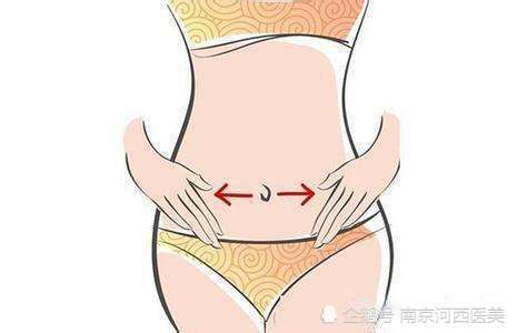 吸脂哪个部位最危险:吸脂哪个部位最危险?医生详解风险与选择 吸脂哪个部位最危险:吸脂哪个部位最危险?医生详解风险与选择