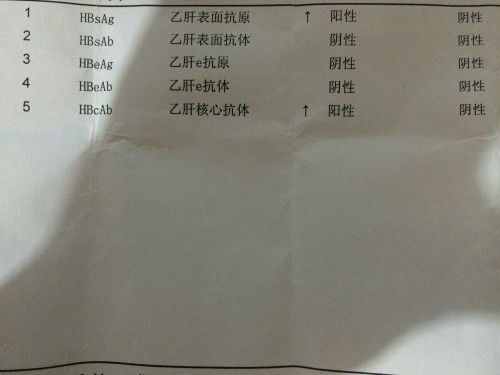 乙肝最轻的是哪一种:乙肝最轻的是哪一种?很多人不知道! 乙肝最轻的是哪一种:乙肝最轻的是哪一种?很多人不知道!