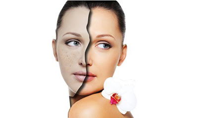 去斑点的最好方法淡斑小妙招:去斑点的最好方法?这些淡斑小妙招你一定要知道! 去斑点的最好方法淡斑小妙招:去斑点的最好方法?这些淡斑小妙招你一定要知道!