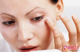 痤疮大概多久可以好:痤疮恢复期有多久?这些因素决定你的皮肤恢复速度 痤疮大概多久可以好:痤疮恢复期有多久?这些因素决定你的皮肤恢复速度