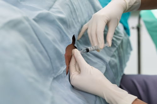 蛇缠腰:蛇缠腰,民间偏方还是科学真相?