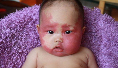 胎记是前世的死因：胎记，前世未解的死亡密码—从灵异传说看生命轮回的隐秘轨迹