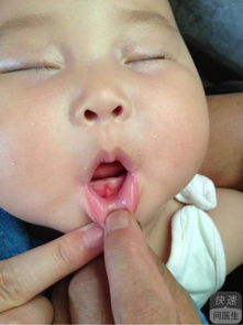 扁桃体炎偏方一天痊愈:扁桃体炎偏方一天痊愈?这些方法或许能帮你缓解不适! 扁桃体炎偏方一天痊愈:扁桃体炎偏方一天痊愈?这些方法或许能帮你缓解不适!