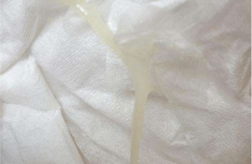 做的时候下面流白色粘稠物:关于身体异常分泌物的常见原因与应对措施 做的时候下面流白色粘稠物:关于身体异常分泌物的常见原因与应对措施