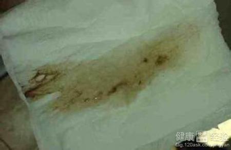 做的时候下面流白色粘稠物:关于身体异常分泌物的常见原因与应对措施