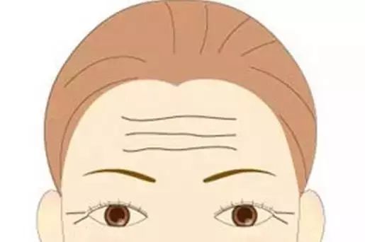 抬头纹太深了用什么方法能去掉:抬头纹太深了?这些方法或许能帮你抚平年龄焦虑 抬头纹太深了用什么方法能去掉:抬头纹太深了?这些方法或许能帮你抚平年龄焦虑