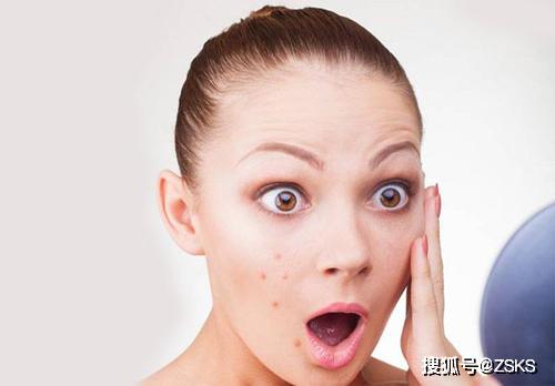 痤疮的最快消除方法:快速击退痤疮!3天见效的高效消除方法 痤疮的最快消除方法:快速击退痤疮!3天见效的高效消除方法