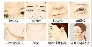 有抬头纹怎么办:告别抬头纹,多种方法有效改善与预防