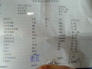 转氨酶300多就死了:转氨酶300多就死了?专家,别被这个土方法误导了!