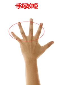 手上各处痣 图解:手上的痣暗藏玄机?图解不同位置揭示健康与运势密码 手上各处痣 图解:手上的痣暗藏玄机?图解不同位置揭示健康与运势密码