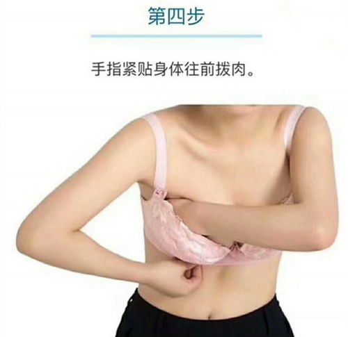 正常副乳图片图：认识正常副乳，如何区分与理解副乳的生理特征