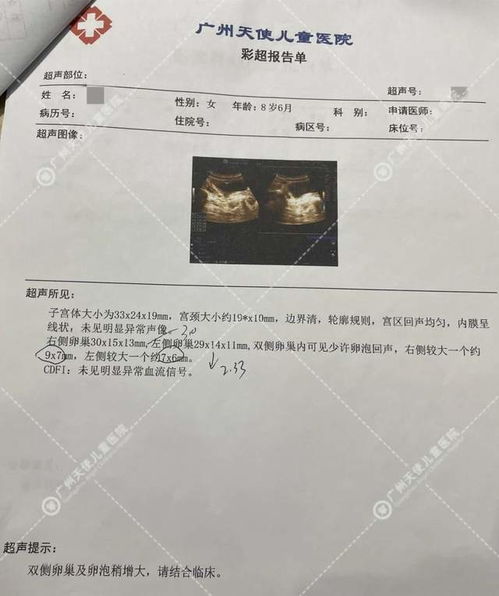 b超单子看男女:B超单子看男女,科学与伦理的边界 b超单子看男女:B超单子看男女,科学与伦理的边界