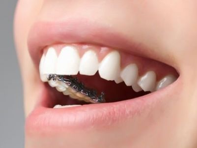 梦见牙齿掉了出血是什么征兆:梦见牙齿掉了出血,一场关于内心世界的隐喻