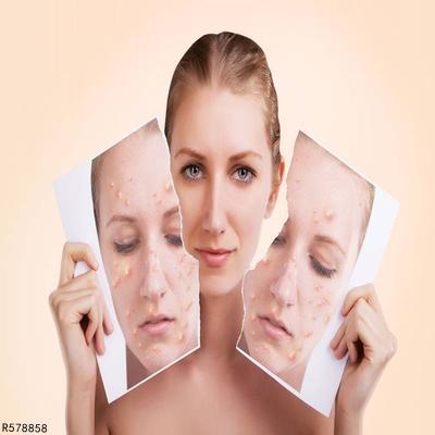 色素沉着怎么快速淡化：色素沉着怎么快速淡化？这些科学方法你一定要知道！