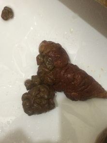 大便带血附在粪便表面:大便带血附在表面,这些原因你必须知道 大便带血附在粪便表面:大便带血附在表面,这些原因你必须知道