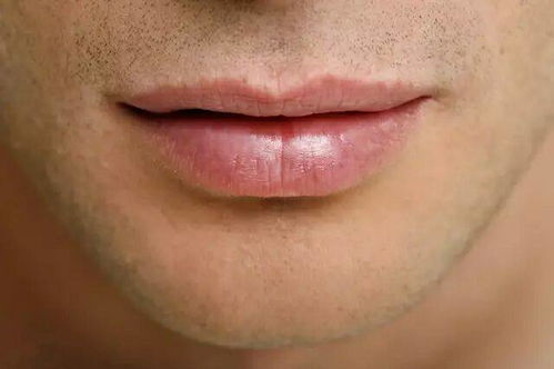 嘴唇变薄手术多少钱:嘴唇变薄手术多少钱?全面解析价格、风险与注意事项