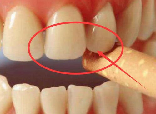 如何去口臭最快最有效的方法:告别口臭尴尬!7天快速有效去口臭指南 如何去口臭最快最有效的方法:告别口臭尴尬!7天快速有效去口臭指南