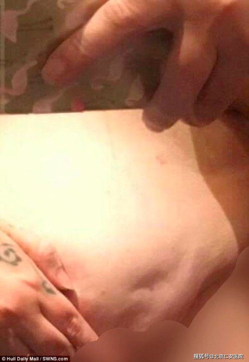 胃癌早期呕吐特点:胃癌早期呕吐特点,警惕这些异常信号