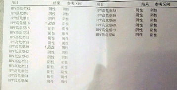 hpv16:HPV16,了解这种高危型人乳头瘤病毒及其预防措施