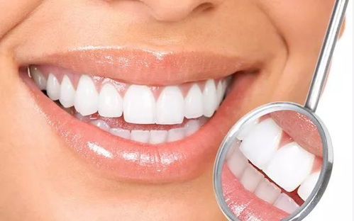 美白牙齿的方法有哪些:牙齿美白方法大揭秘,告别黄牙,自信微笑 美白牙齿的方法有哪些:牙齿美白方法大揭秘,告别黄牙,自信微笑
