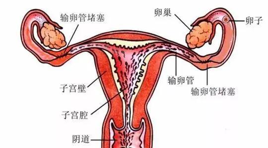 子宫肌瘤自愈的最佳方法:子宫肌瘤自愈的黄金法则,温和调理与日常习惯的完美结合 子宫肌瘤自愈的最佳方法:子宫肌瘤自愈的黄金法则,温和调理与日常习惯的完美结合