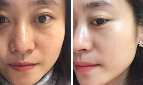 怎么可以变白:如何健康有效地改善肤色,实现自然白皙