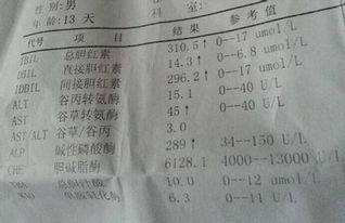 黄疸值多少正常范围:新生儿黄疸值多少正常?标准范围解读与指南