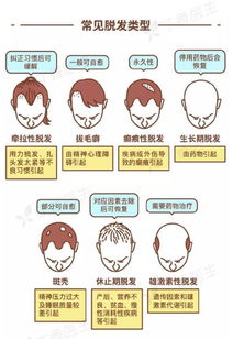 头顶脱发是什么原因:探索头顶脱发的根源,从压力到遗传,全面解析脱发原因