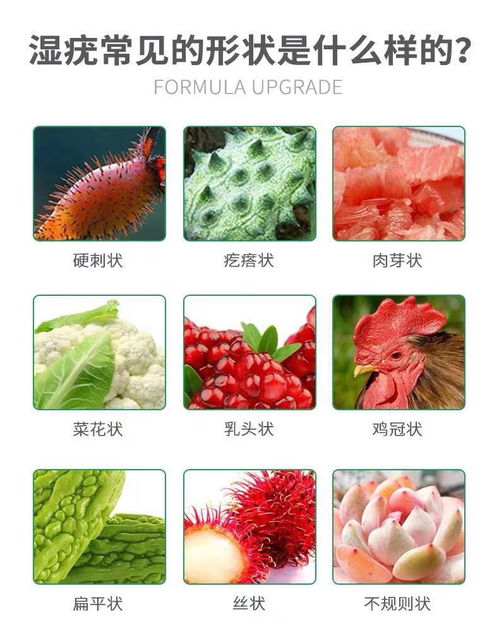 尖锐疣湿早期症状图片：尖锐疣湿早期症状图片，你必须知道的警示信号