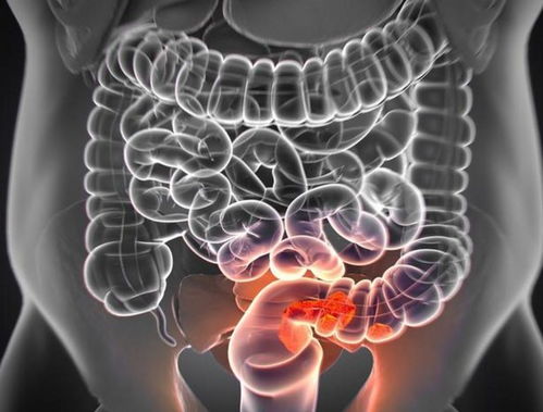 怎样判断肠道有寄生虫：如何判断肠道是否有寄生虫？这些症状和自测方法要了解