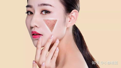 雀斑怎么自己去掉：自然淡化雀斑，温和方法自己消除肌肤印记