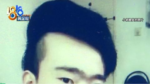 植发是拆东墙补西墙吗：植发，是拆东墙补西墙的权宜之计，还是重拾自信的有效途径？