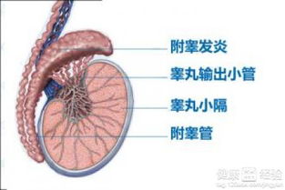附睾炎症状：附睾炎症状，男性健康不可忽视的警示信号