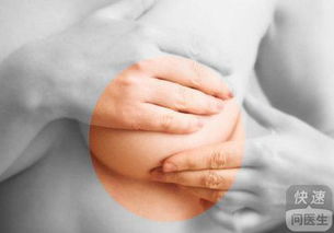 乳腺癌的症状:警惕乳腺癌早期信号,这些症状不容忽视