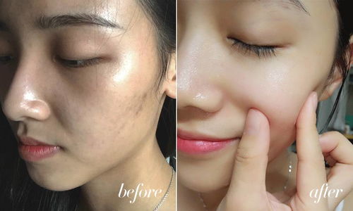 脸上的斑斑点点怎么去除:告别斑斑点点,重拾无瑕肌肤,科学方法助你有效去除脸上的色斑
